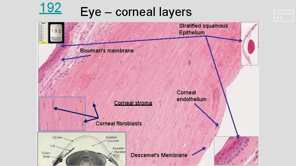 192 Eye – corneal layers Stratified squamous Epithelium Bowman's membrane Corneal stroma Corneal endothelium