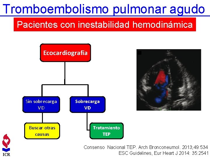 Tromboembolismo pulmonar agudo Pacientes con inestabilidad hemodinámica Ecocardiografía Sin sobrecarga VD Buscar otras causas