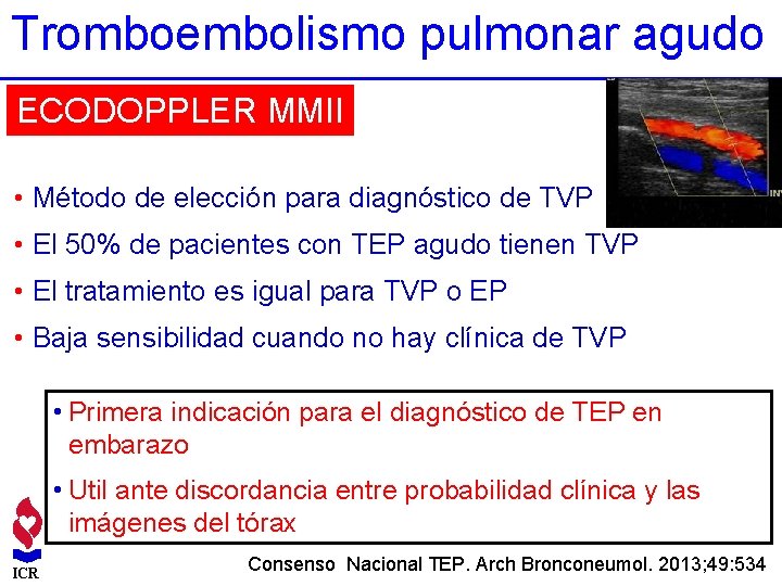 Tromboembolismo pulmonar agudo ECODOPPLER MMII • Método de elección para diagnóstico de TVP •