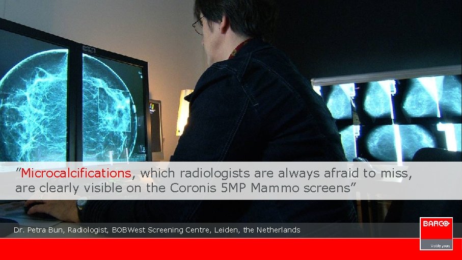 ”Microcalcifications, which radiologists are always afraid to miss, are clearly visible on the Coronis