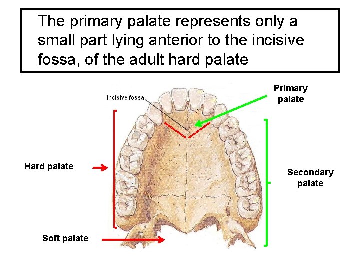 The primary palate represents only a small part lying anterior to the incisive fossa,