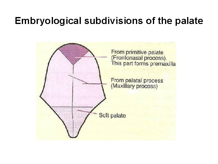 Embryological subdivisions of the palate 