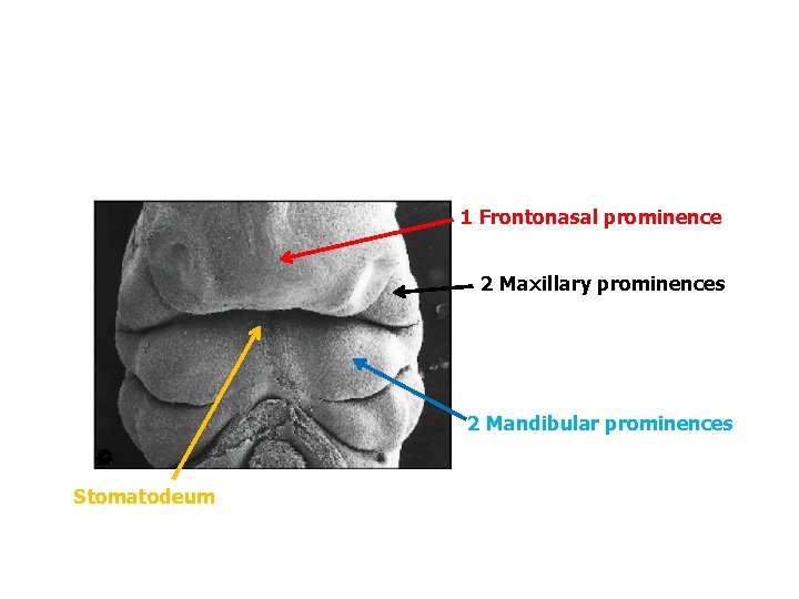 1 Frontonasal prominence 2 Maxillary prominences 2 Mandibular prominences Stomatodeum 