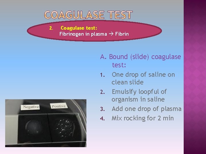 2. Coagulase test: Fibrinogen in plasma Fibrin A. Bound (slide) coagulase test: 1. One