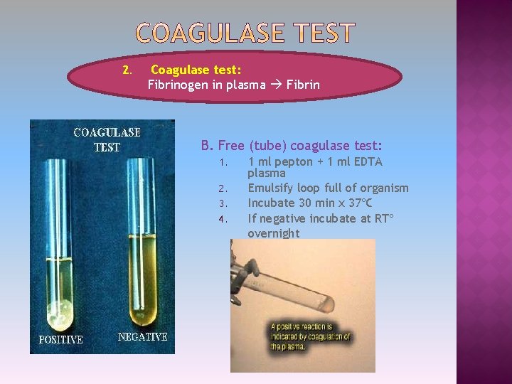 2. Coagulase test: Fibrinogen in plasma Fibrin B. Free (tube) coagulase test: 1. 2.
