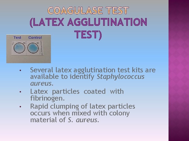 (LATEX AGGLUTINATION TEST) • • • Several latex agglutination test kits are available to