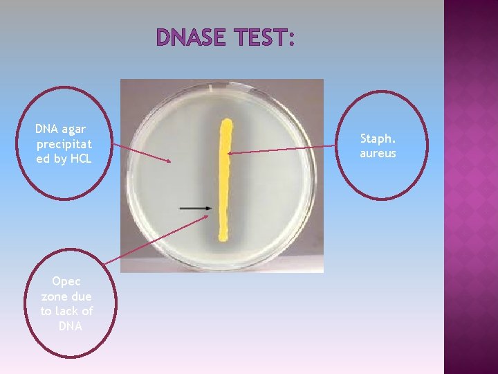 DNASE TEST: DNA agar precipitat ed by HCL Opec zone due to lack of