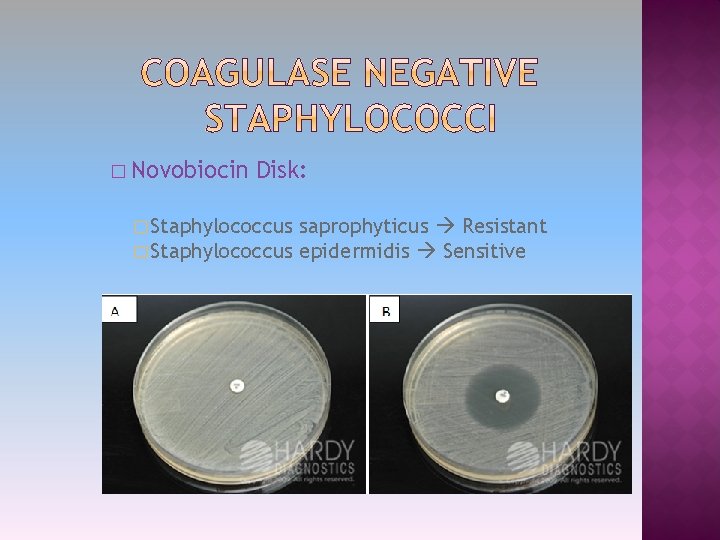 � Novobiocin Disk: � Staphylococcus saprophyticus Resistant epidermidis Sensitive 