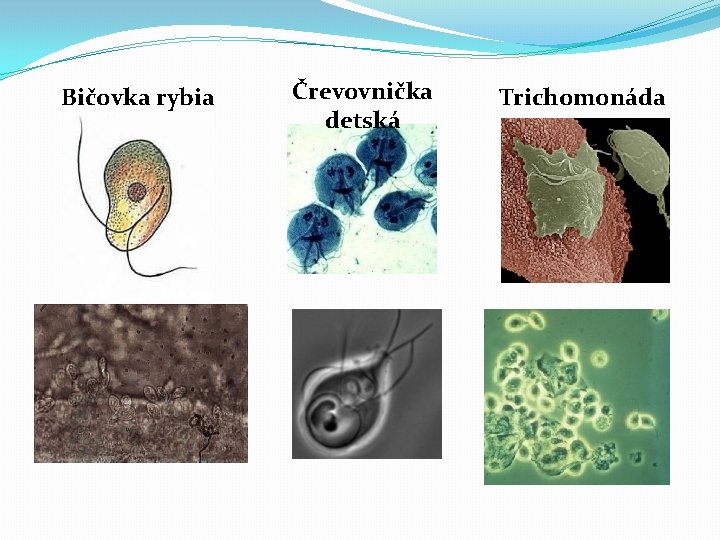 Bičovka rybia Črevovnička detská Trichomonáda 