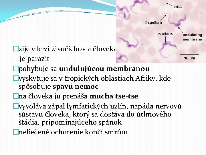 �žije v krvi živočíchov a človeka, je parazit �pohybuje sa undulujúcou membránou �vyskytuje sa