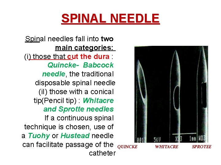 SPINAL NEEDLE Spinal needles fall into two main categories: (i) those that cut the