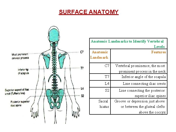 SURFACE ANATOMY Anatomic Landmarks to Identify Vertebral Levels Anatomic Features Landmark C 7 T