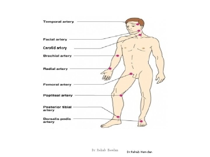 Carotid artery Dr: Rehab Hemdan 