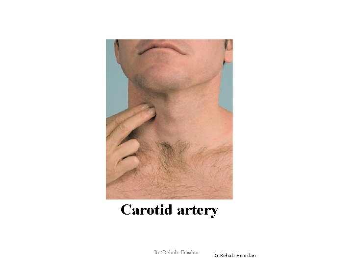 Carotid artery Dr: Rehab Hemdan 