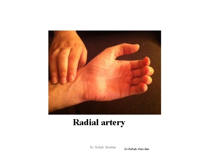 Radial artery Dr: Rehab Hemdan 