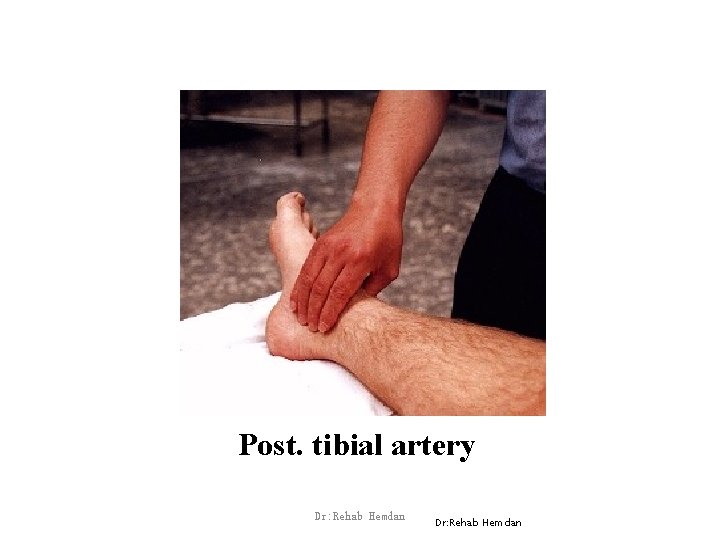 Post. tibial artery Dr: Rehab Hemdan 