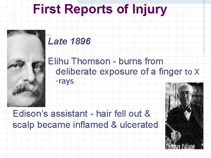First Reports of Injury Late 1896 Elihu Thomson - burns from deliberate exposure of