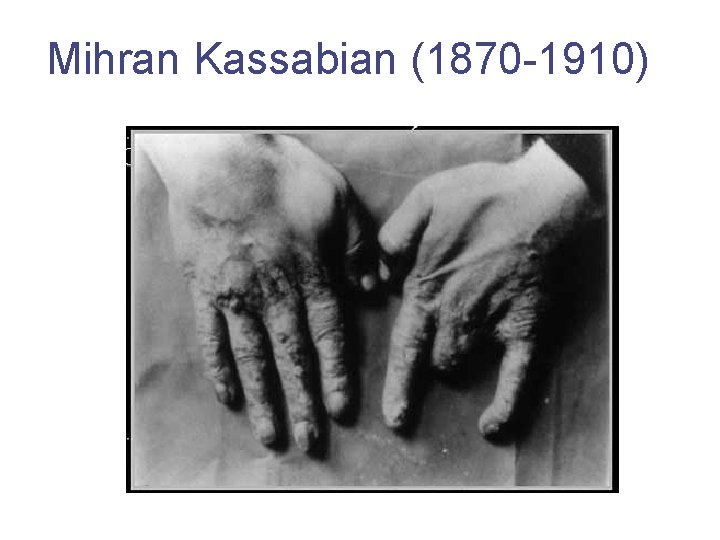 Mihran Kassabian (1870 -1910) 