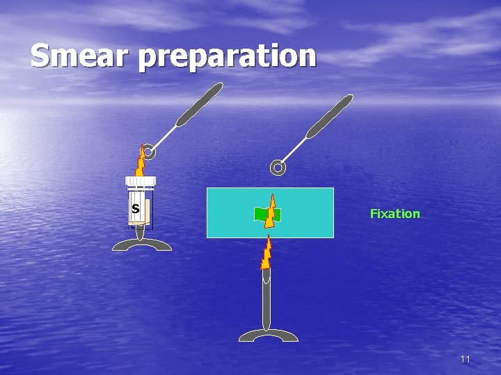 Smear preparation S Fixation 11 