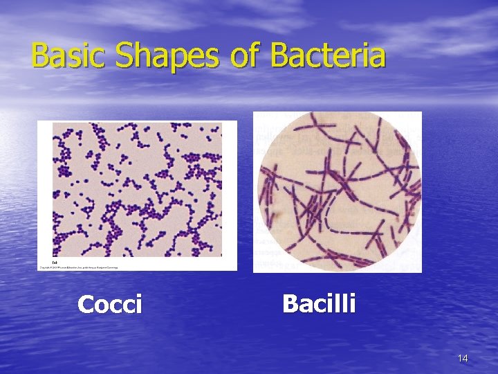 Basic Shapes of Bacteria Cocci Bacilli 14 