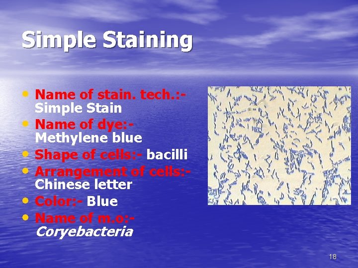 Simple Staining • Name of stain. tech. : • • • Simple Stain Name