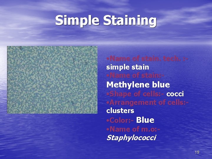 Simple Staining • Name of stain. tech. : simple stain • Name of stain: