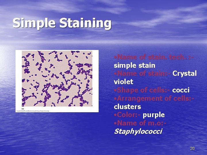 Simple Staining • Name of stain. tech. : simple stain • Name of stain: