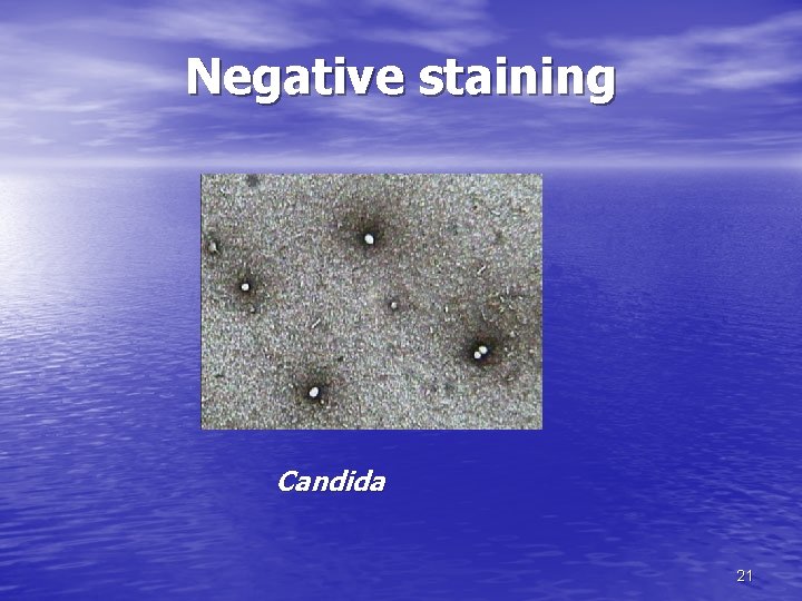 Negative staining Candida 21 