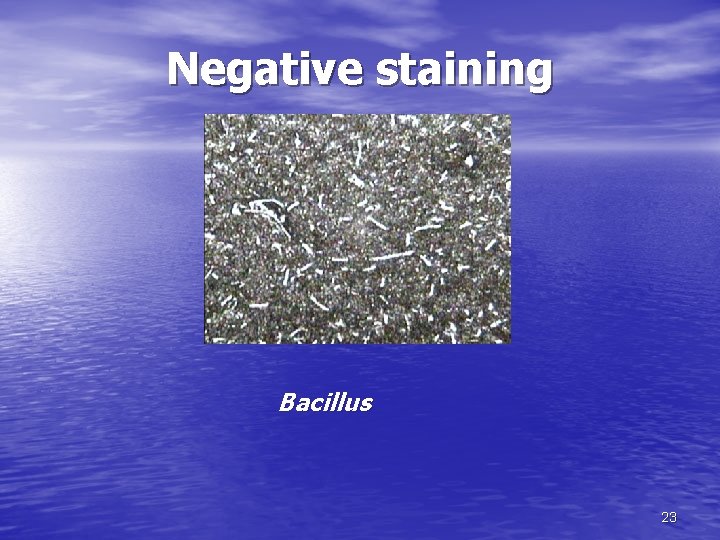 Negative staining Bacillus 23 