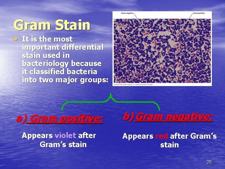 Gram Stain • It is the most important differential stain used in bacteriology because