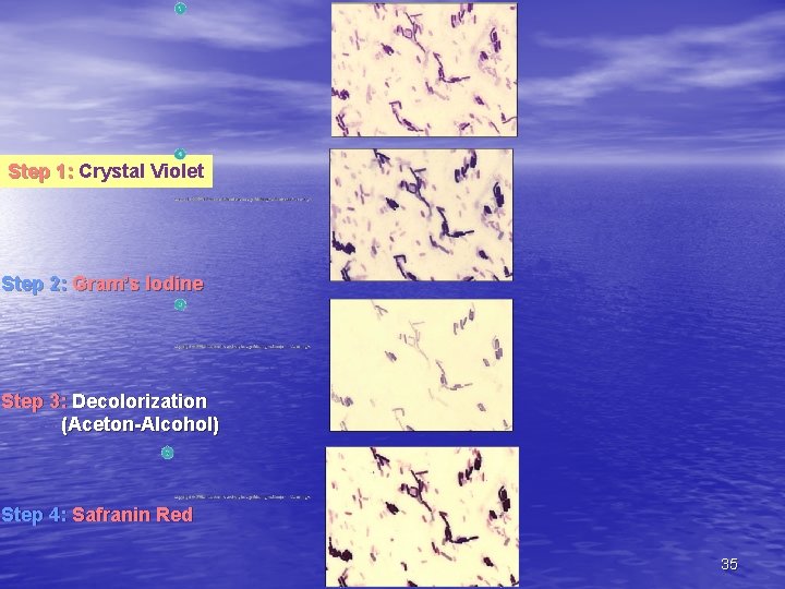 Step 1: Crystal Violet Step 2: Gram’s Iodine Step 3: Decolorization (Aceton-Alcohol) Step 4: