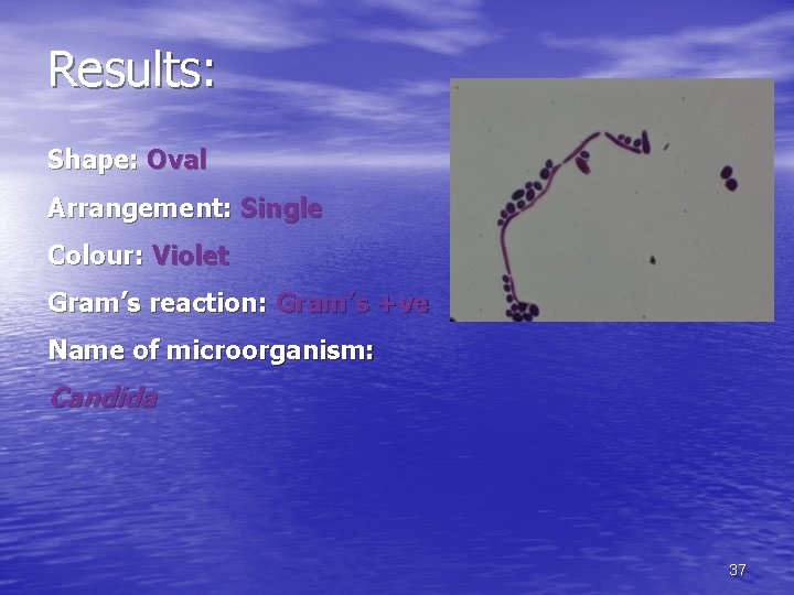 Results: Shape: Oval Arrangement: Single Colour: Violet Gram’s reaction: Gram’s +ve Name of microorganism: