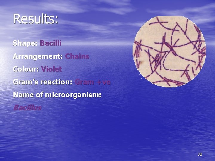 Results: Shape: Bacilli Arrangement: Chains Colour: Violet Gram’s reaction: Gram +ve Name of microorganism:
