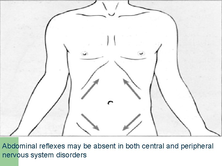 Abdominal reflexes may be absent in both central and peripheral nervous system disorders 