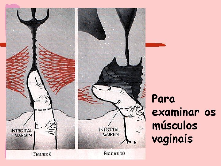 Para examinar os músculos vaginais 