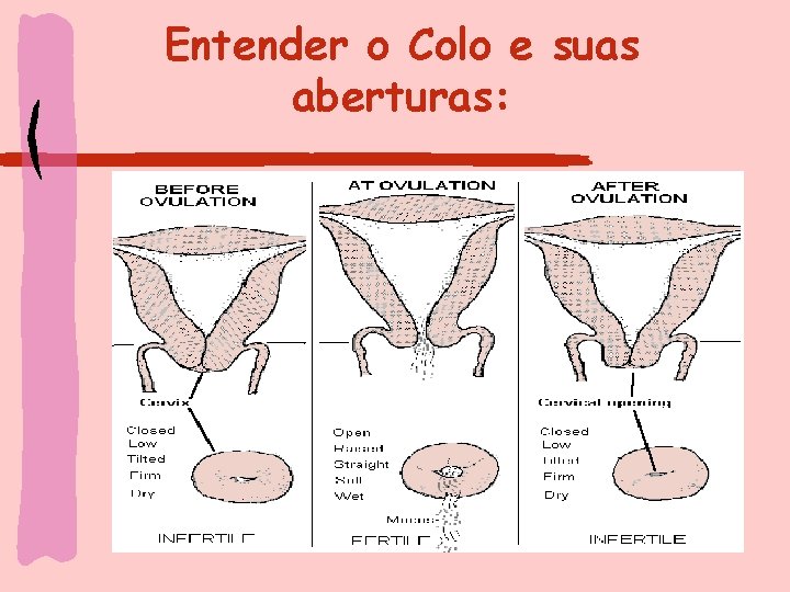 Entender o Colo e suas aberturas: 