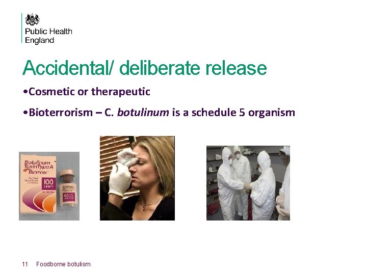 Accidental/ deliberate release • Cosmetic or therapeutic • Bioterrorism – C. botulinum is a