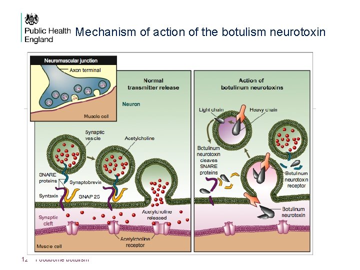 Mechanism of action of the botulism neurotoxin 12 Foodborne botulism 