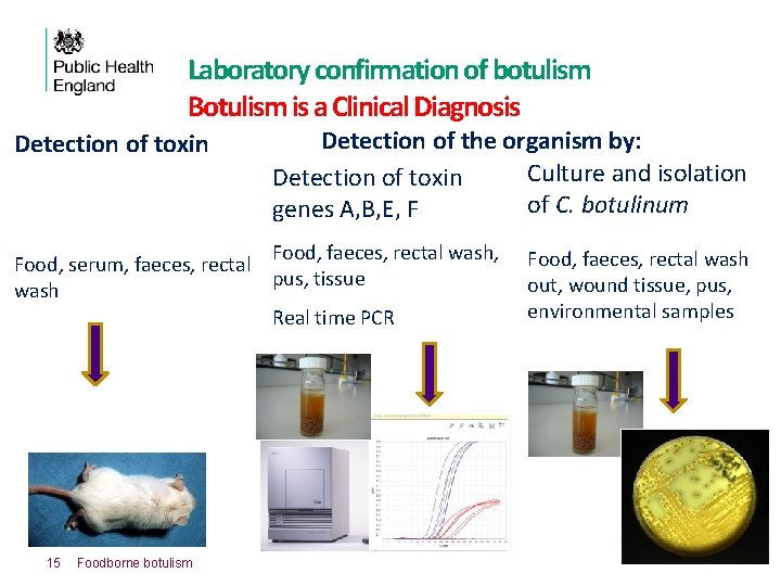 Laboratory confirmation of botulism Botulism is a Clinical Diagnosis Detection of toxin Detection of