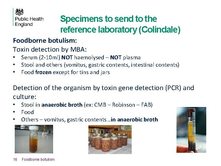 Specimens to send to the reference laboratory (Colindale) Foodborne botulism: Toxin detection by MBA: