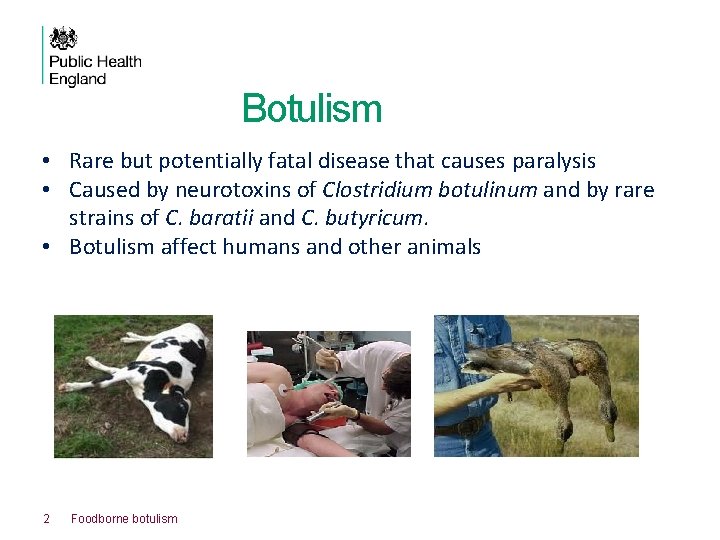 Botulism • Rare but potentially fatal disease that causes paralysis • Caused by neurotoxins