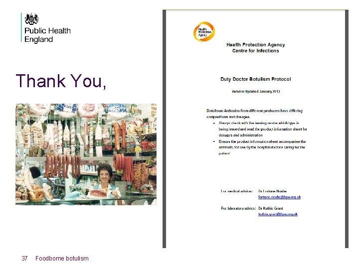 Thank You, 37 Foodborne botulism 
