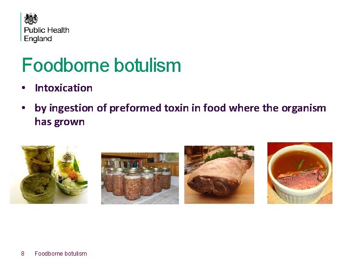 Foodborne botulism • Intoxication • by ingestion of preformed toxin in food where the