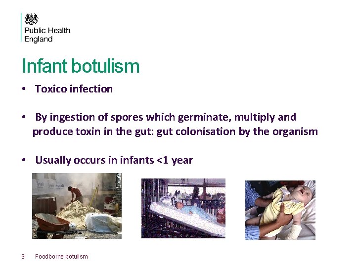 Infant botulism • Toxico infection • By ingestion of spores which germinate, multiply and