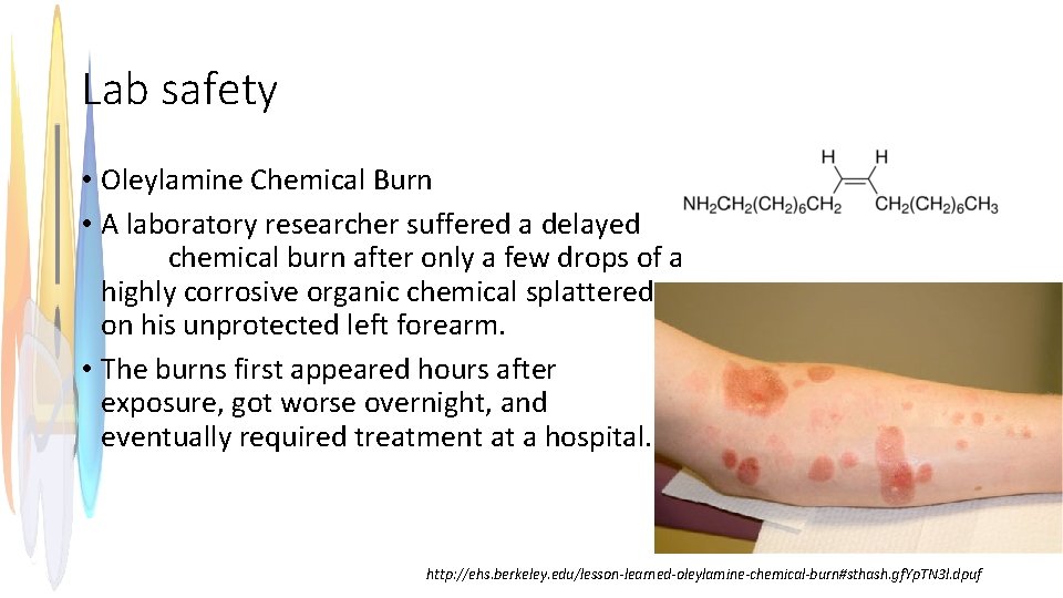 Lab safety • Oleylamine Chemical Burn • A laboratory researcher suffered a delayed chemical