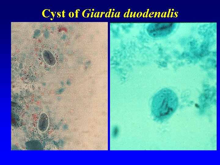 Cyst of Giardia duodenalis 