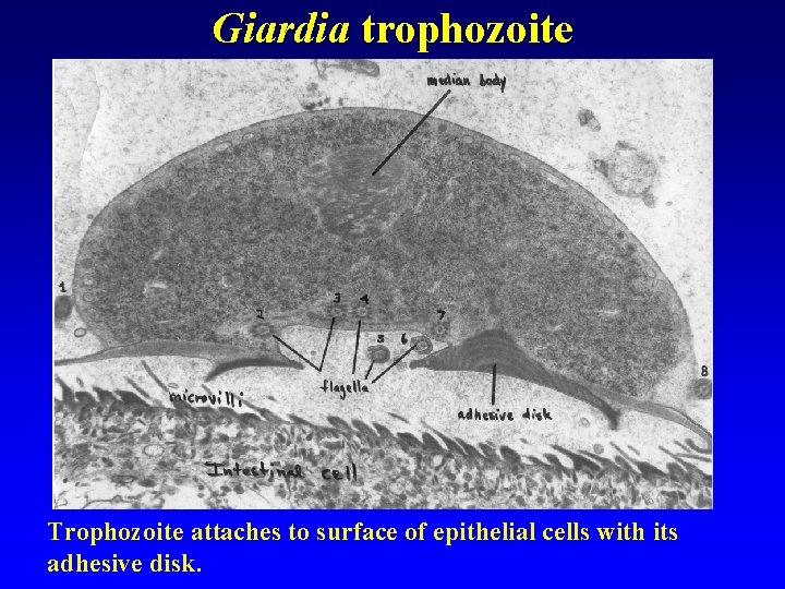 Giardia trophozoite Trophozoite attaches to surface of epithelial cells with its adhesive disk. 