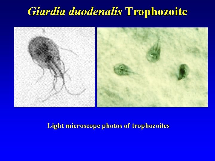 Giardia duodenalis Trophozoite Light microscope photos of trophozoites 