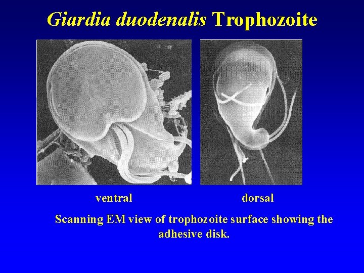 Giardia duodenalis Trophozoite ventral dorsal Scanning EM view of trophozoite surface showing the adhesive