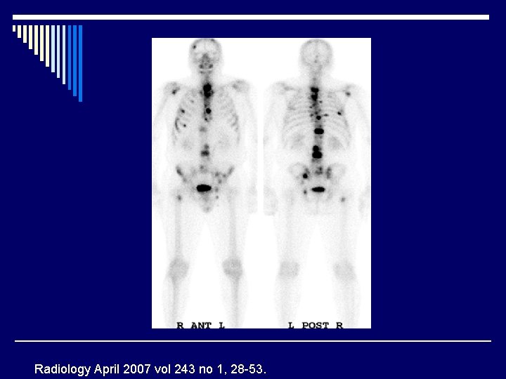 Radiology April 2007 vol 243 no 1, 28 -53. 